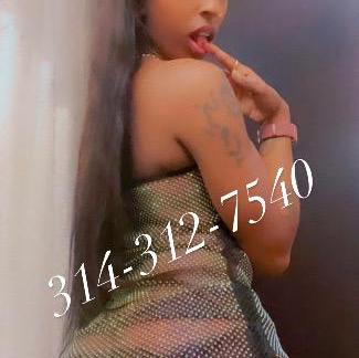  is Female Escorts. | St. Louis | Missouri | United States | AmorousHug