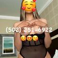  is Female Escorts. | Louisville | Kentucky | United States | AmorousHug