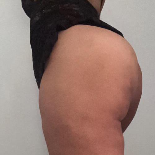  is Female Escorts. | Worcester | Massachusetts | United States | AmorousHug