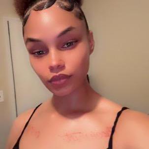  is Female Escorts. | San Mateo | California | United States | AmorousHug