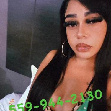  is Female Escorts. | Fresno | California | United States | AmorousHug