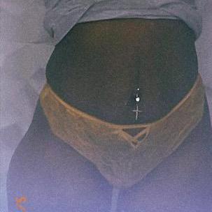  is Female Escorts. | Brooklyn | New York | United States | AmorousHug