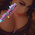  is Female Escorts. | Fresno | California | United States | AmorousHug