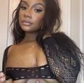  is Female Escorts. | Sacramento | California | United States | AmorousHug