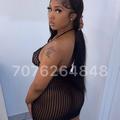  is Female Escorts. | Modesto | California | United States | AmorousHug