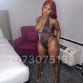  is Female Escorts. | Modesto | California | United States | AmorousHug