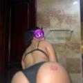  is Female Escorts. | Hudson Valley | New York | United States | AmorousHug