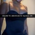  is Female Escorts. | Niagara | Ontario | Canada | AmorousHug
