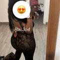  is Female Escorts. | Visalia | California | United States | AmorousHug